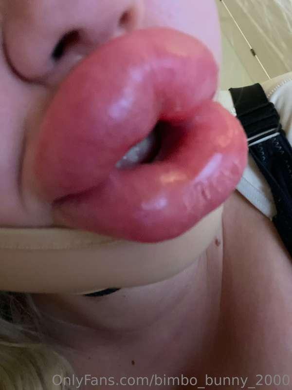 My lips are so swollen from the medication 💕🙈 do you like it..