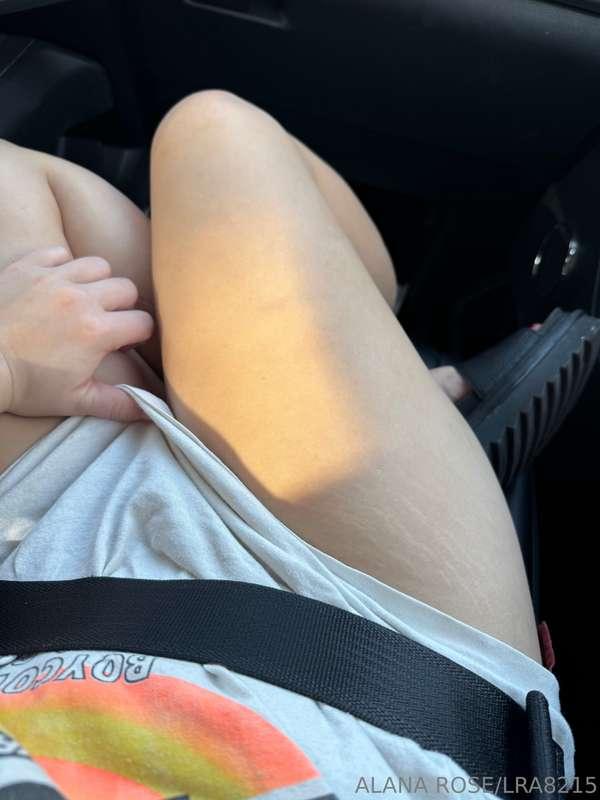 Stretch marks anyone? They remind me of tiger stripes! I hop..