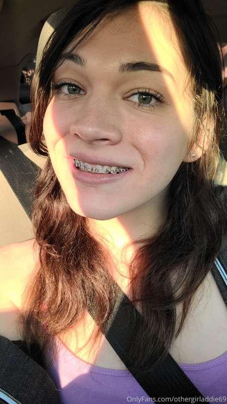 Got braces today. Wonder how this will effect sucking dick 🤔..