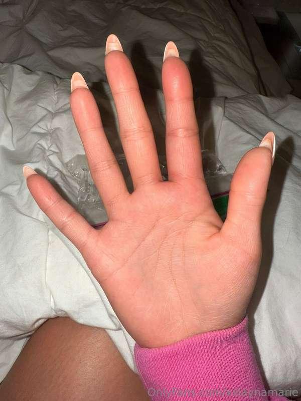 i didn’t know bee stings could get this swollen! 😳