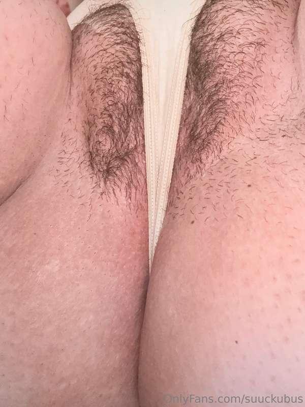 what do you think of my moles?