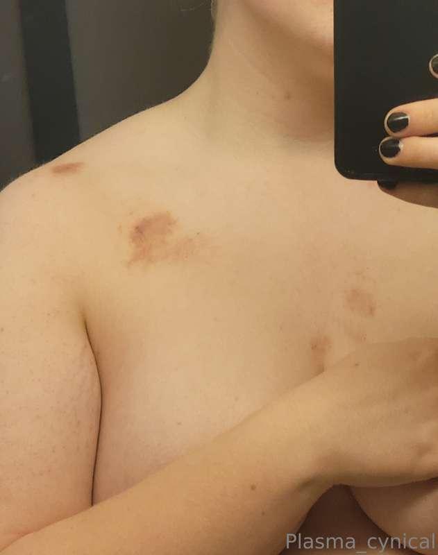 Video of me showering + photo of the hickeys I got when I vi..