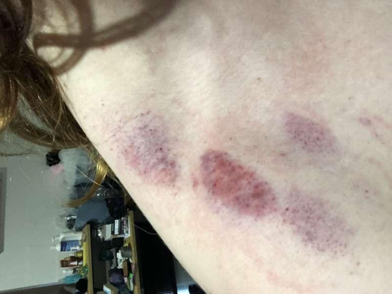 Do you guys like giving or receiving hickies? 