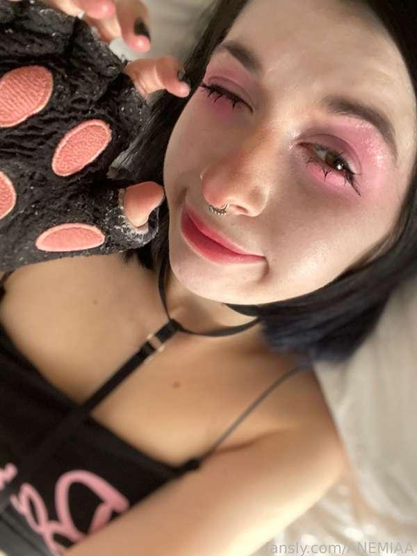 anemiaa image #5