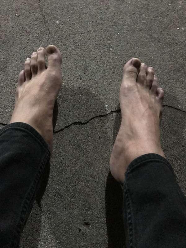 Step on a crack...