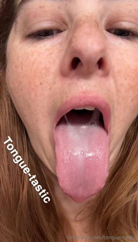 Fatty tongue