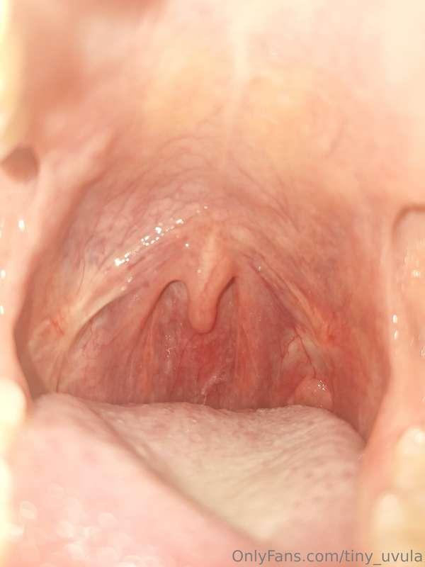 tiny_uvula image #0