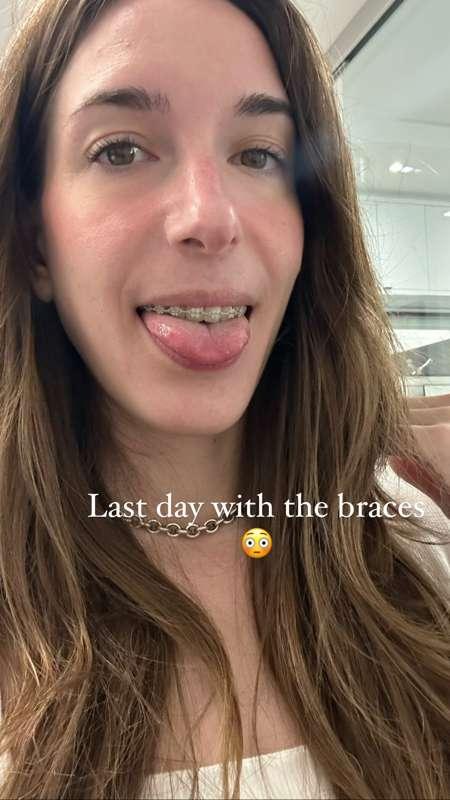 Well today was the day. 

I got my braces removed. I’m still..