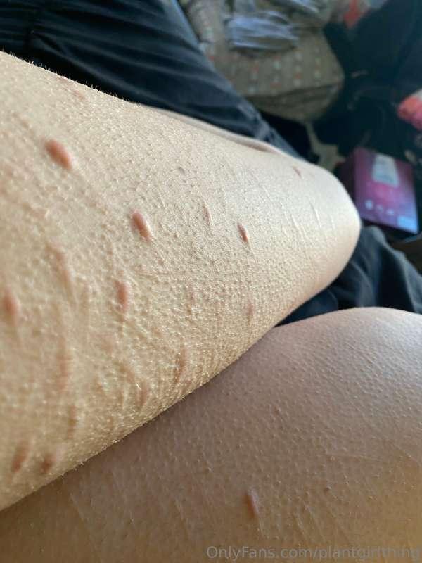 getting goosebumps from being fucked in the ass is a little ..