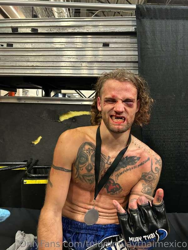 Nick had an absolute war on the weekend. He fought Jake Peac..