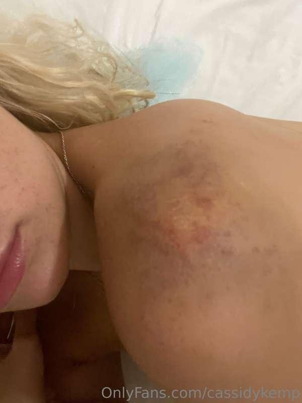 healing in a remote ass town on a lagoon in Mexico on the bo..