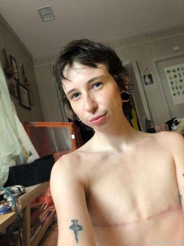 mikah_ftm image #1