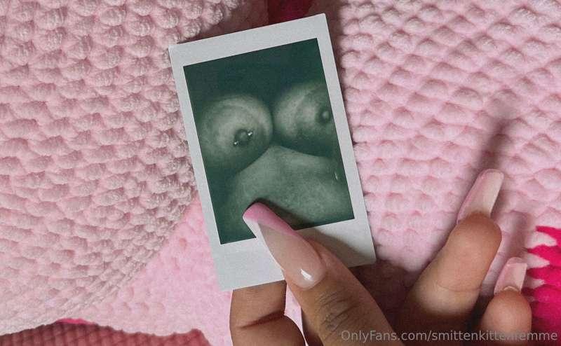 Areolas 🩷