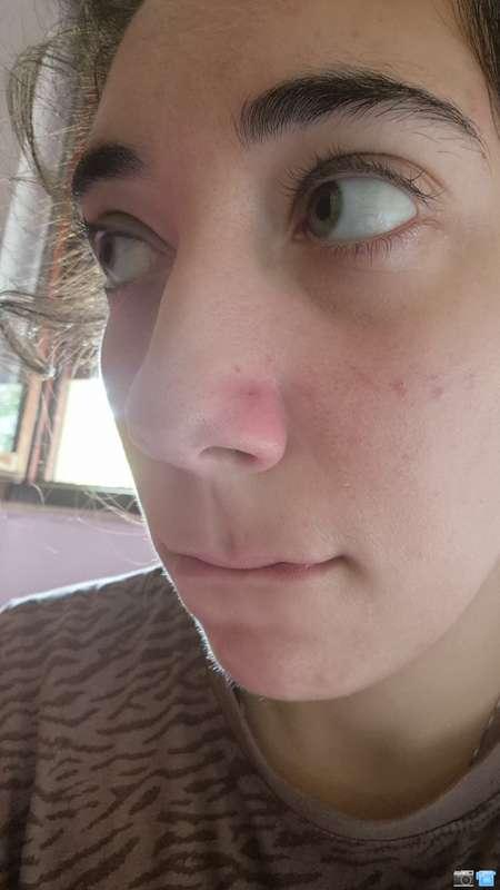 Ho provato a togliere il piercing per vedere un po e se rich..