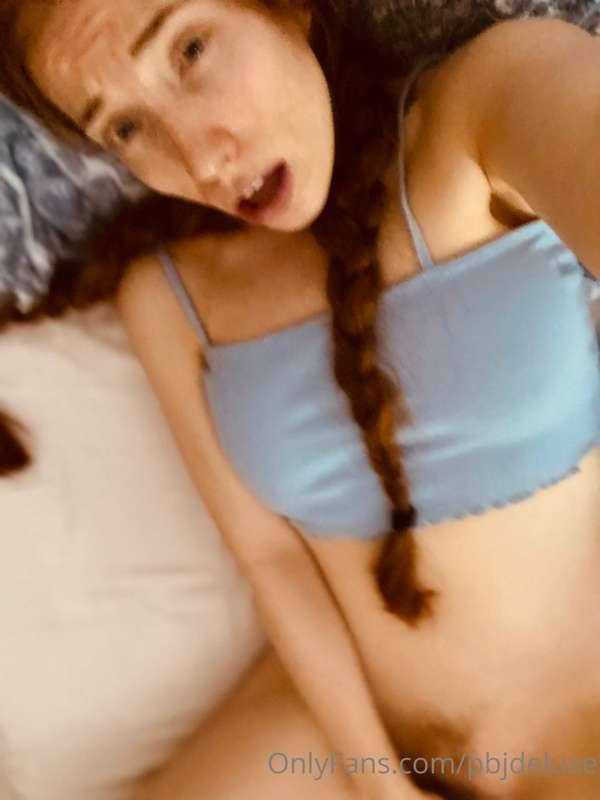 redbuns image #2