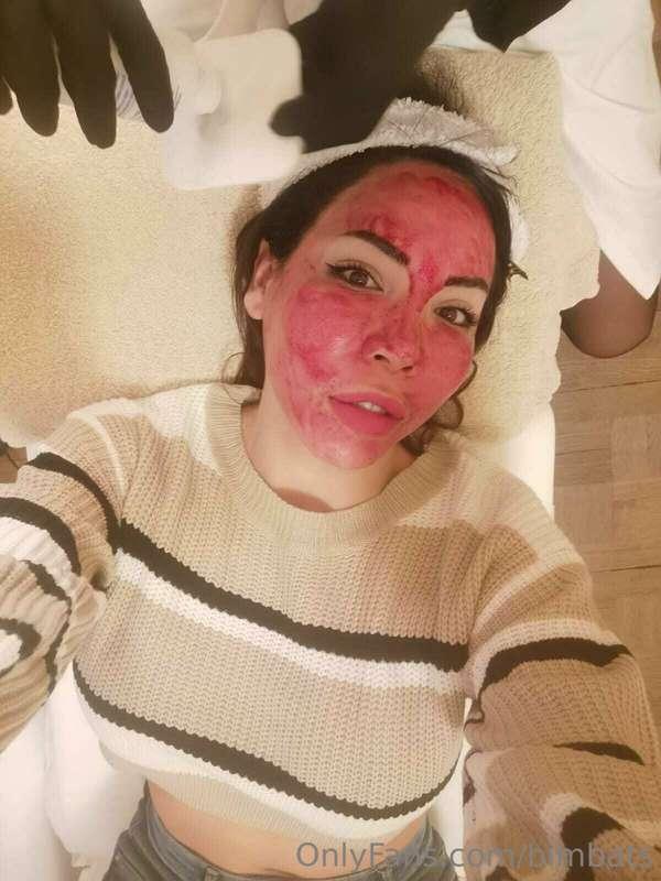 bloody treatment finished.. 
that Corage I have 🤦‍♀️
