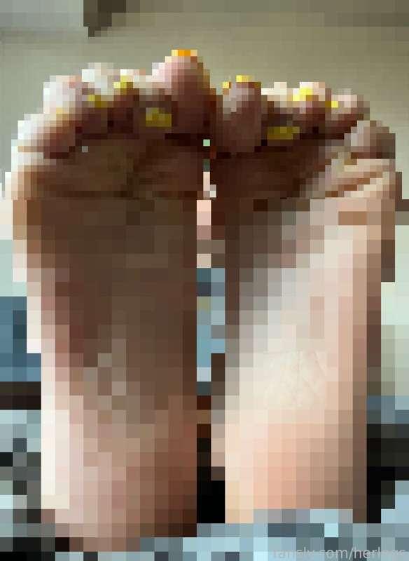 herlegs image #0
