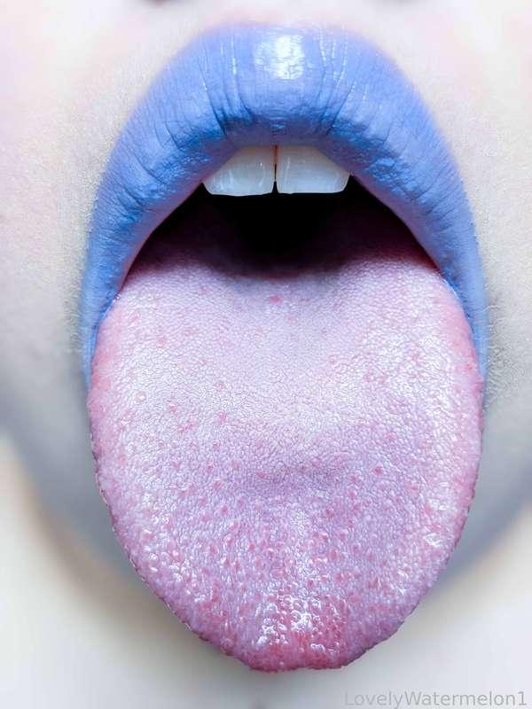 lovelywatermelon1 image #11