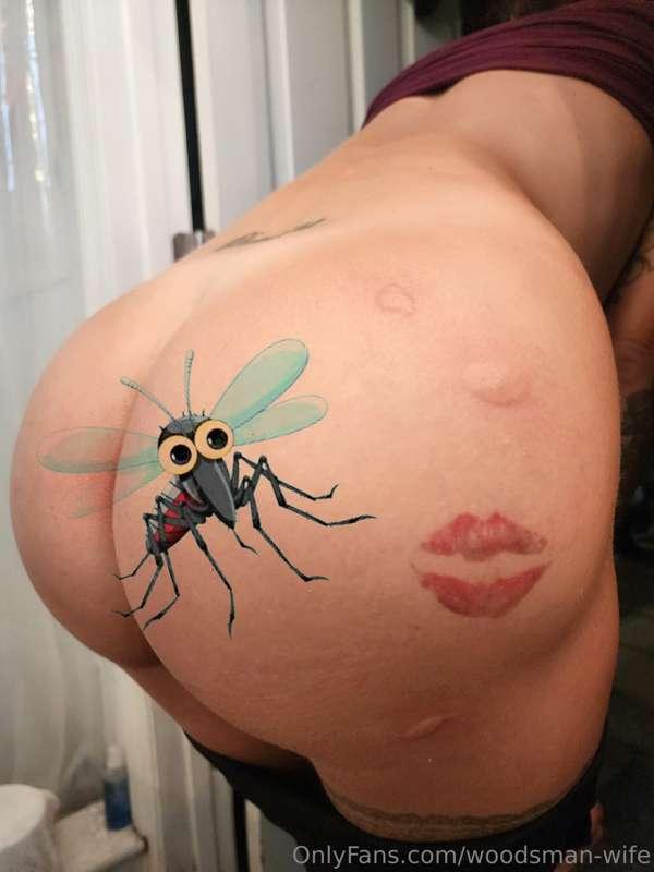 Mosquitoes said "that ass is so juicy I'm gonna eat it!"