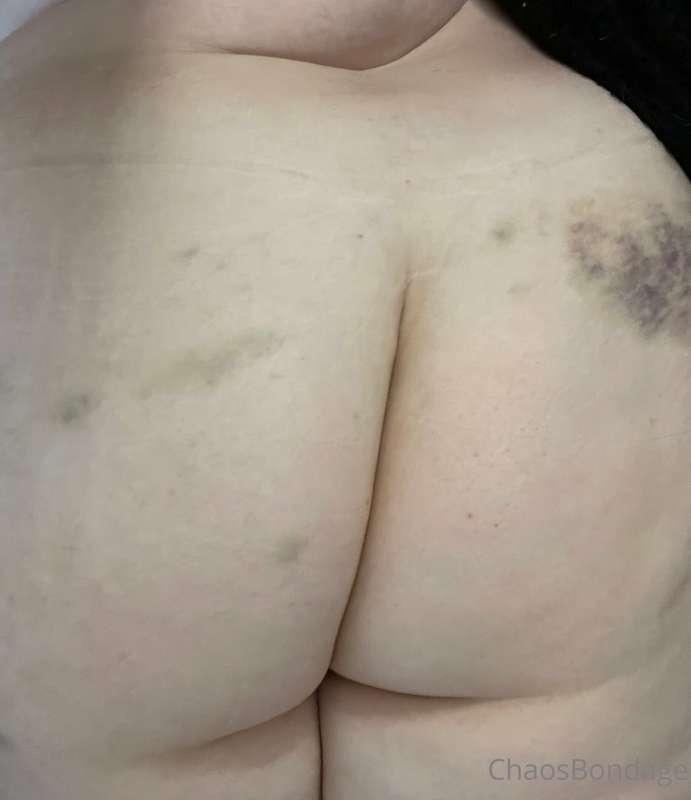 Got some mighty fine bruises on vacation! The impact play wa..