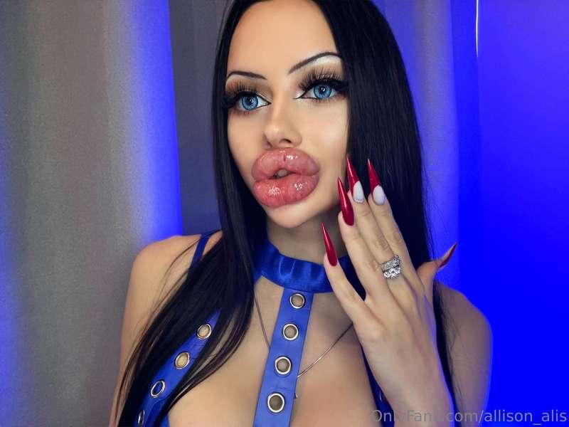 MY SWOLLEN JUST INJECTED LIPS 💉 NEW VIDEO🔥 Squeezing and bit..