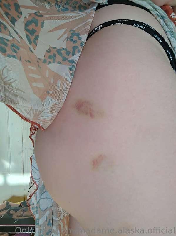 I hurt myself a bit 🫣