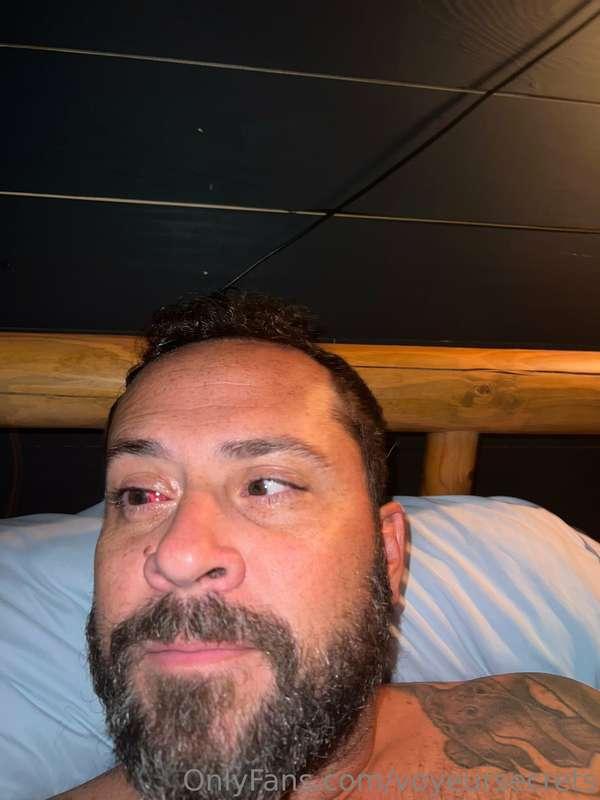 Might be gruesome, but it was a quick eye surgery.