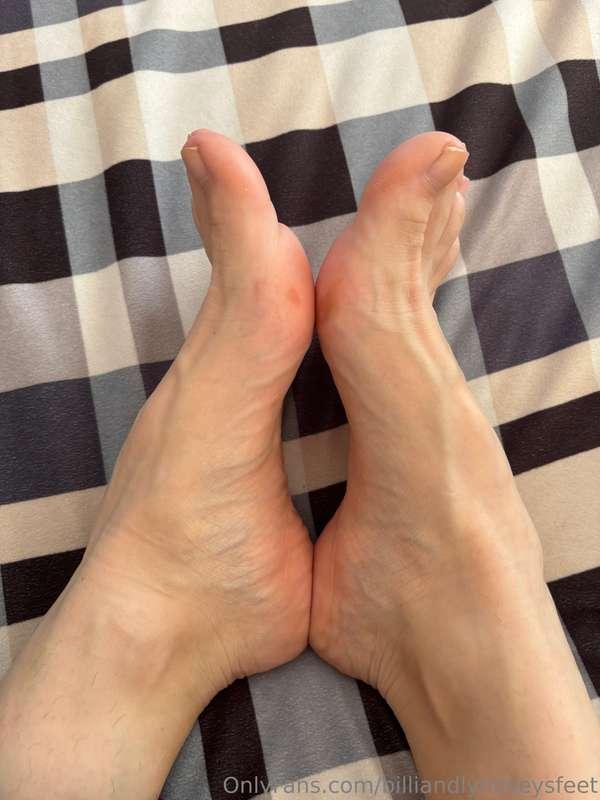 Don't mind my blisters 🙏