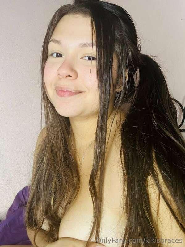 kikisbraces image #2