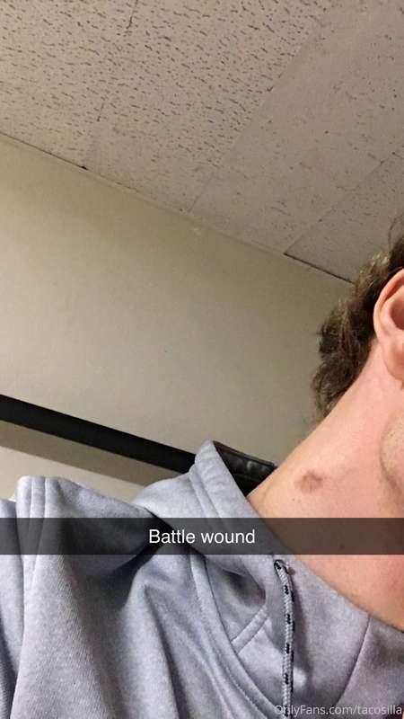 Here is the Hickey you guys wanted to see from this weekend
