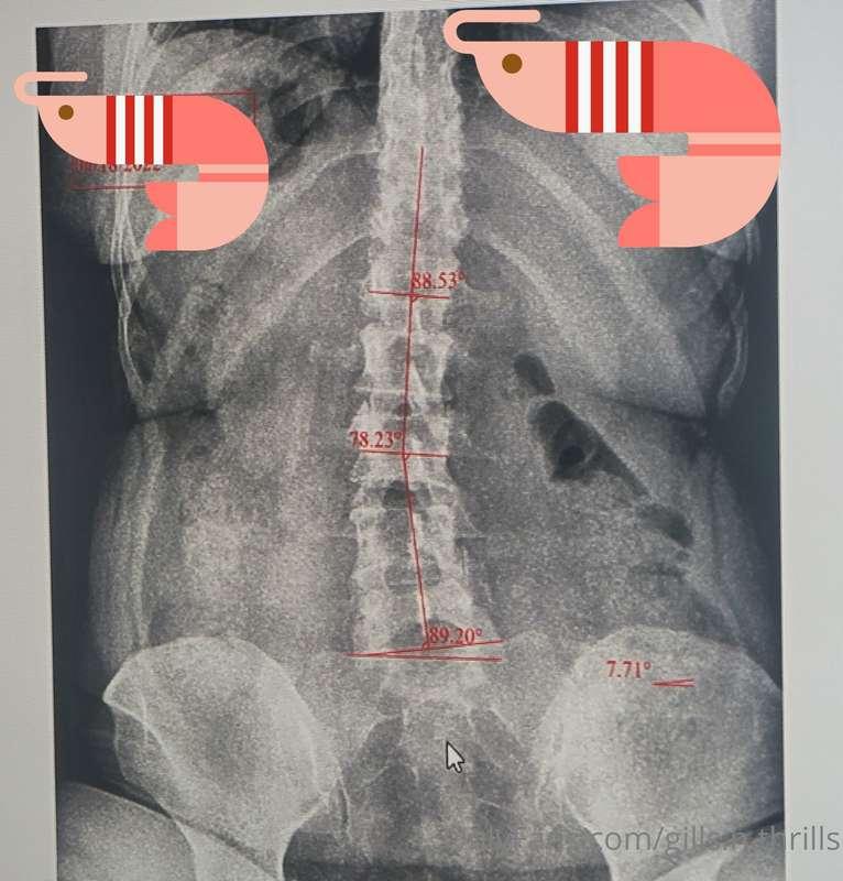 Anyone into bone stuff? Have been having a lot of back pain ..