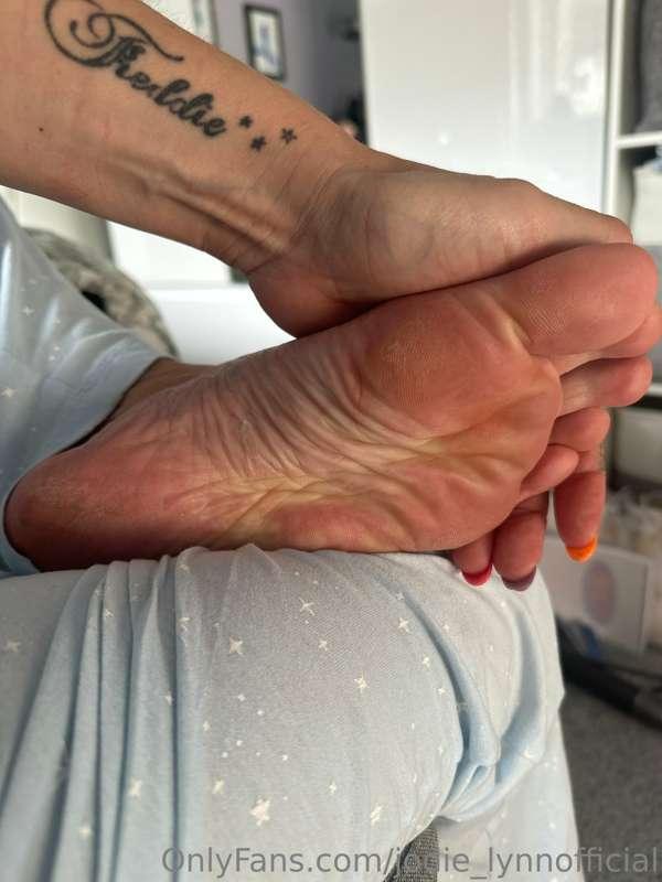 Squashed foot