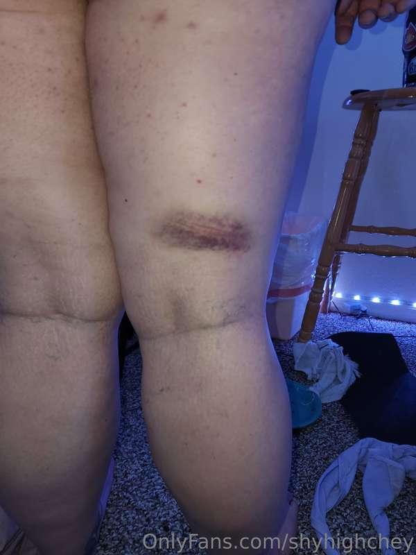 I tapped out after this hit from the large cane 🥴❤️