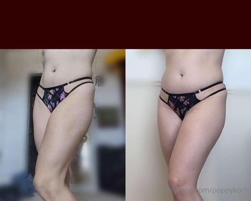 The picture on the left is from summer 2019 when I was 27 - ..