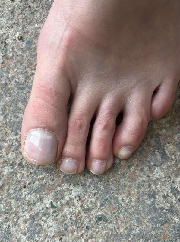 My nail broke and I’m fuming! Pedi 2 weeks away 😤