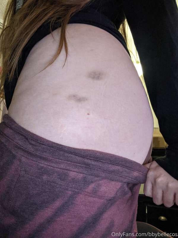 If you had the chance would you leave little love bites like..