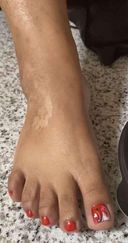 Hi there! My name is “Una” and I’m an amputee. This page is ..