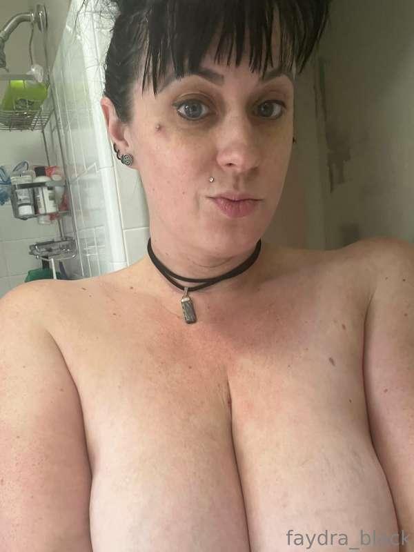 I took my chest dermals out!!!!