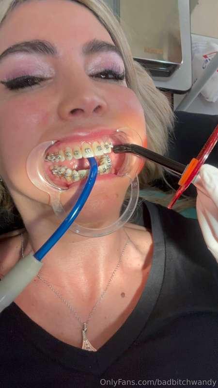 Laser and water hose, what else would you put in my mouth?