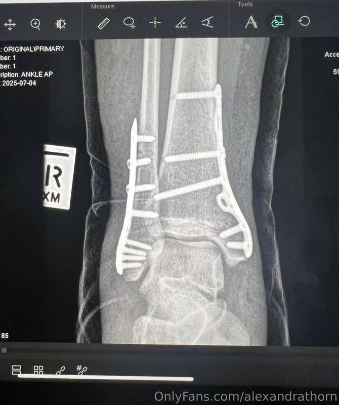 Hey everyone 👋.Just wanted to check in with a quick update a..