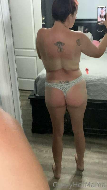 the aftermath of tanning my booty yesterday. I think I fried..