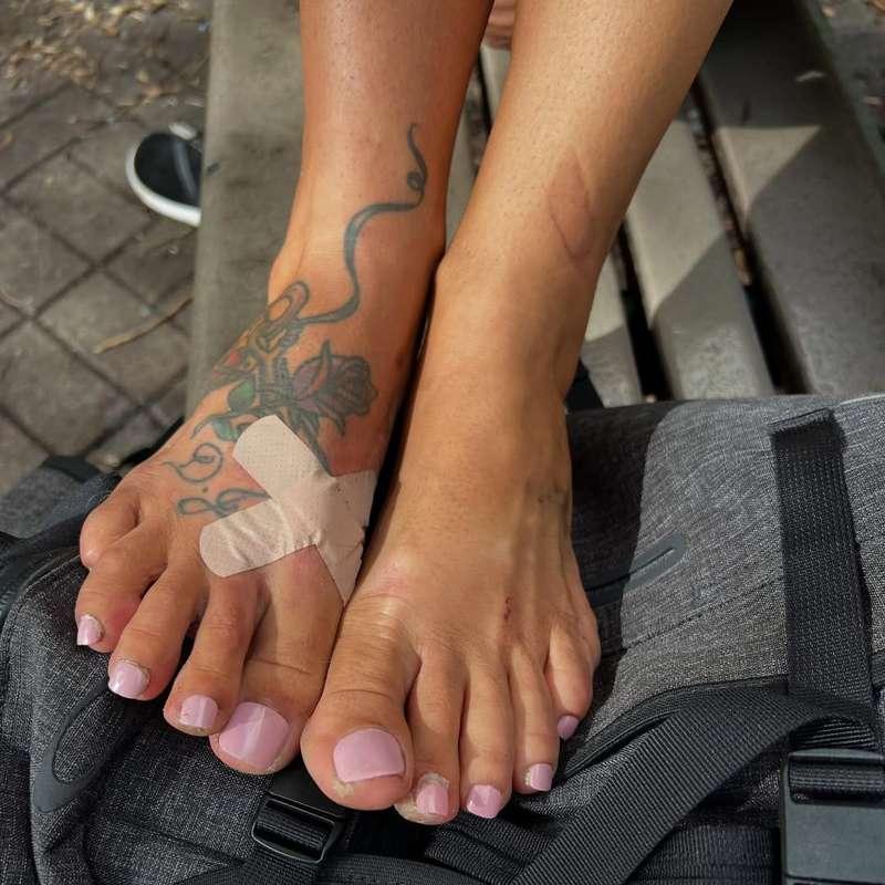 Candid homeless women stinky feet