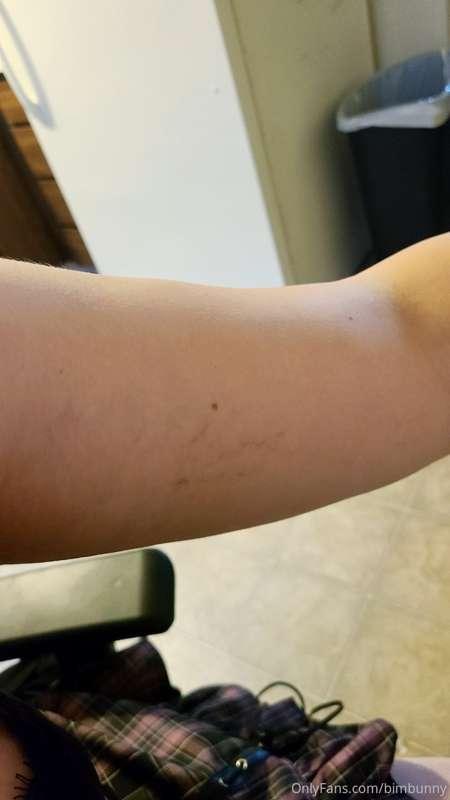 Stretch mark appreciation post plus some vids of me actually..