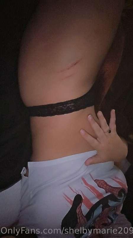 Battle scars from work 😈