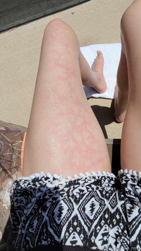 I'm so pale/white that I turn red almost immediately after b..