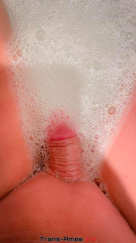 DM