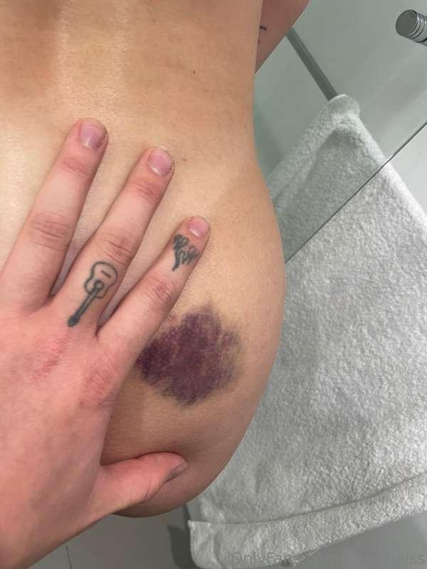 sooooo I fell off the side of my bed and landed on my ass ri..
