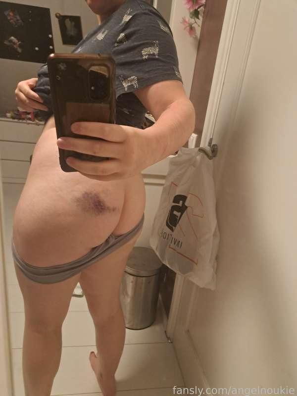 No ass pics for a while cuz i fell off the stairs lmaoo