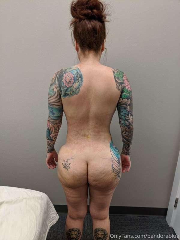 Just had my 2nd massage on the 8th day of healing from my Br..