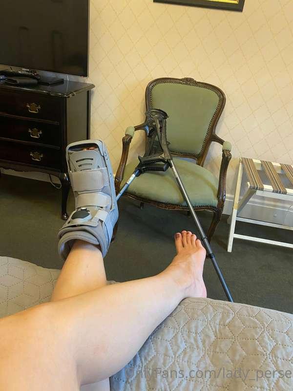 Hi everyone! I recently broke my foot! Well, not every party..